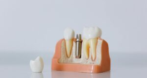 Why Dentures? Revolutionary Teeth Regeneration Technology Offers Hope to Indians