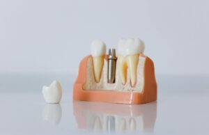 Why Dentures? Revolutionary Teeth Regeneration Technology Offers Hope to Indians