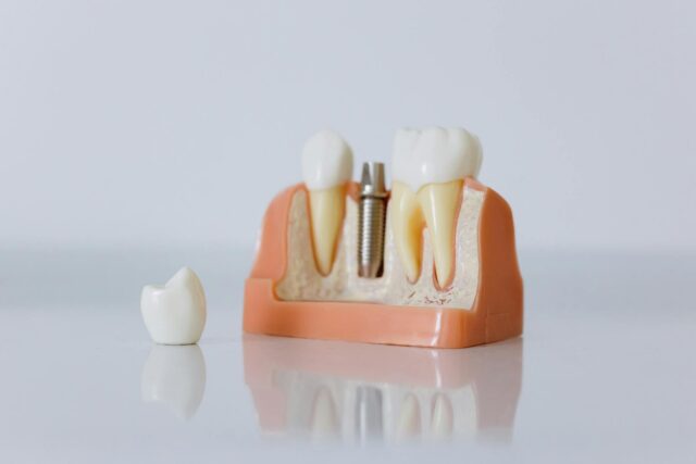 grow-new-teeth-dentures-regeneration-technology