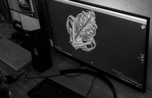 IIT-Madras Creates First 3D Atlas of Human Brainstem: A Game-Changer for Medical Science