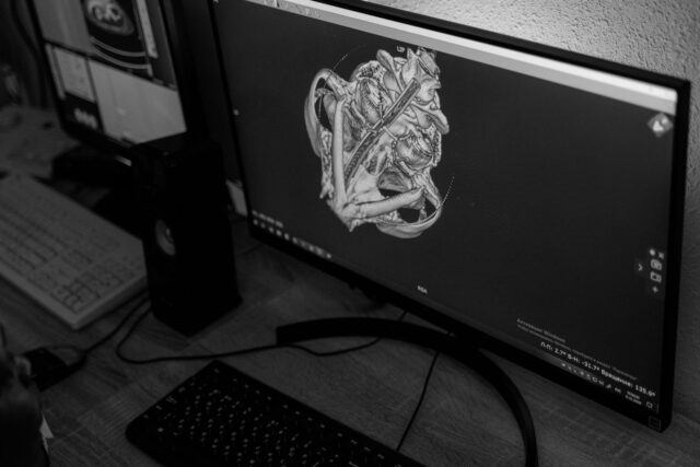 iit-madras-3d-atlas-human-brainstem