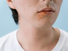 Can Kissing Spread Herpes? What Indians Need to Know About This Common STI
